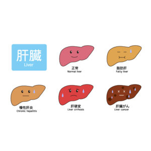 肝臓の病気の無料カラーイラスト