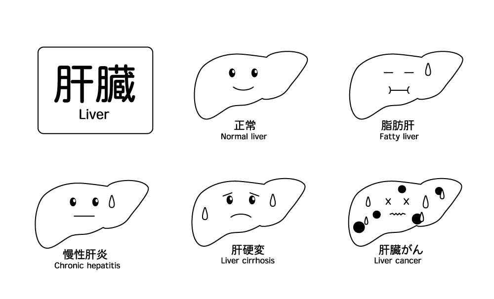 病気の肝臓の無料モノクロイラスト