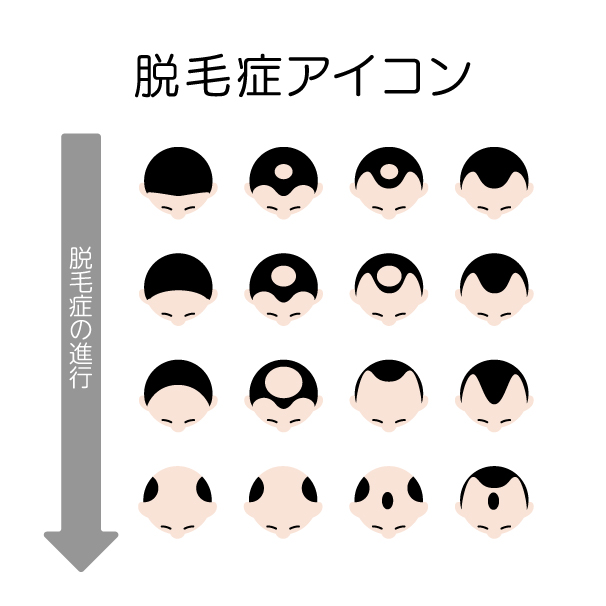 脱毛症のアイコンセットの無料線なしイラスト