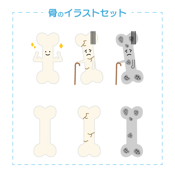 骨の健康状態と骨粗しょう症のイラストセットの無料線なしイラスト